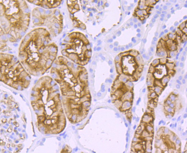 Paraformaldehyde-fixed and paraffin-embedded Human kidney tissue incubated with AQP1 (9C8) Monoclonal Antibody (bsm-52909R) at 1:100, overnight at 4°C, followed by a conjugated secondary antibody and DAB staining. Counterstained with hematoxylin.