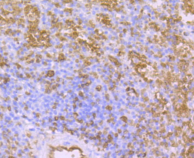 Paraformaldehyde-fixed and paraffin-embedded Human spleen tissue incubated with AQP1 (9C8) Monoclonal Antibody (bsm-52909R) at 1:100, overnight at 4°C, followed by a conjugated secondary antibody and DAB staining. Counterstained with hematoxylin.
