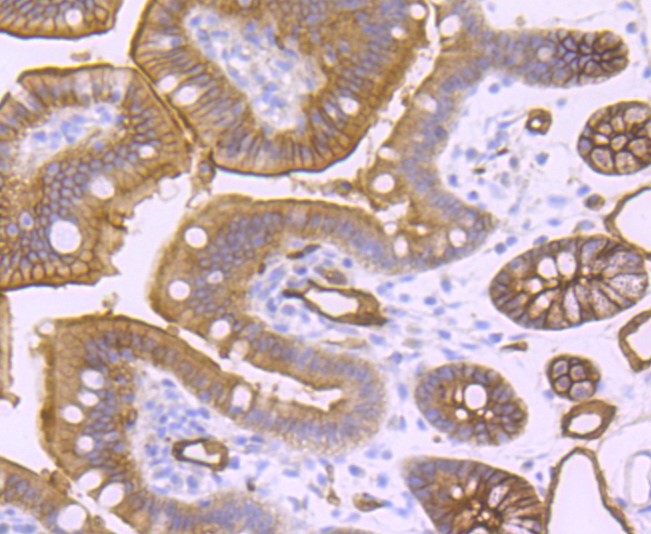Paraformaldehyde-fixed and paraffin-embedded Mouse colon tissue incubated with AQP1 (9C8) Monoclonal Antibody (bsm-52909R) at 1:100, overnight at 4°C, followed by a conjugated secondary antibody and DAB staining. Counterstained with hematoxylin.