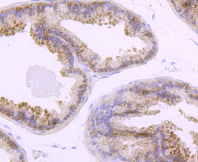 Paraformaldehyde-fixed and paraffin-embedded Mouse prostate tissue incubated with TLR5 (6C1) Monoclonal Antibody (bsm-52905R) at 1:100, overnight at 4°C, followed by a conjugated secondary antibody and DAB staining. Counterstained with hematoxylin.