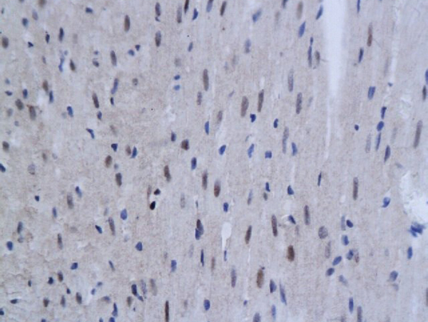 Formalin-fixed and paraffin embedded rat myocardium labeled with Anti-TNFAIP3  Polyclonal Antibody, Unconjugated (bs-2803R) at 1:200 followed by conjugation to the secondary antibody and DAB staining
