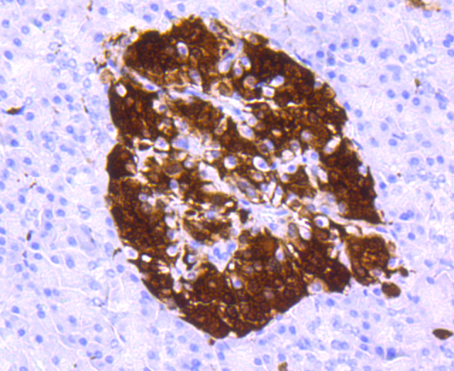 Paraformaldehyde-fixed and paraffin-embedded Human pancreas tissue incubated with PGP9.5 (2A1) Monoclonal Antibody (bsm-52897R) at 1:100, overnight at 4\u00b0C, followed by a conjugated secondary antibody and DAB staining. Counterstained with hematoxylin.