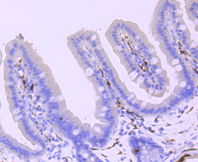 Paraformaldehyde-fixed and paraffin-embedded Mouse colon tissue incubated with PGP9.5 (2A1) Monoclonal Antibody (bsm-52897R) at 1:100, overnight at 4\u00b0C, followed by a conjugated secondary antibody and DAB staining. Counterstained with hematoxylin.