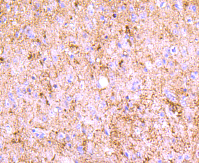 Paraformaldehyde-fixed and paraffin-embedded Mouse spinal cord tissue incubated with PGP9.5 (2A1) Monoclonal Antibody (bsm-52897R) at 1:100, overnight at 4\u00b0C, followed by a conjugated secondary antibody and DAB staining. Counterstained with hematoxylin.