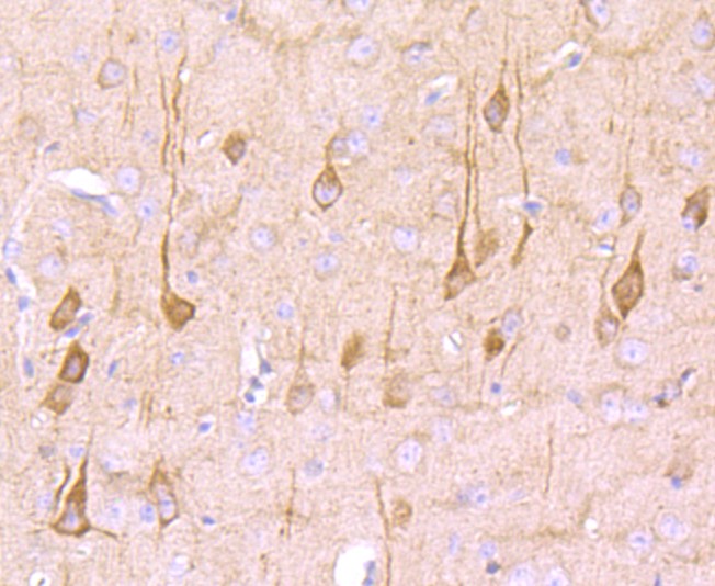 Paraformaldehyde-fixed and paraffin-embedded Mouse brain tissue incubated with NG2 (3A8) Monoclonal Antibody (bsm-52891R) at 1:100, overnight at 4°C, followed by a conjugated secondary antibody and DAB staining. Counterstained with hematoxylin.