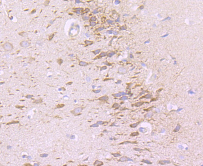 Paraformaldehyde-fixed and paraffin-embedded Rat brain tissue incubated with NG2 (3A8) Monoclonal Antibody (bsm-52891R) at 1:100, overnight at 4°C, followed by a conjugated secondary antibody and DAB staining. Counterstained with hematoxylin.