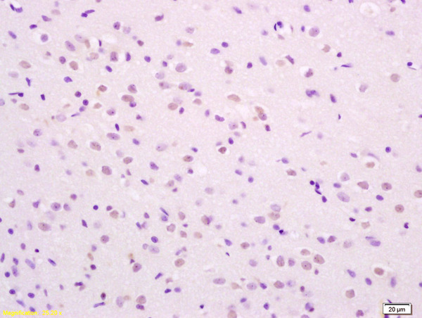 Formalin-fixed and paraffin embedded rat brain labeled with Rabbit Anti phospho-SHC(Ser36) Polyclonal Antibody, Unconjugated (bs-3410R) at 1:200 followed by conjugation to the secondary antibody and DAB staining