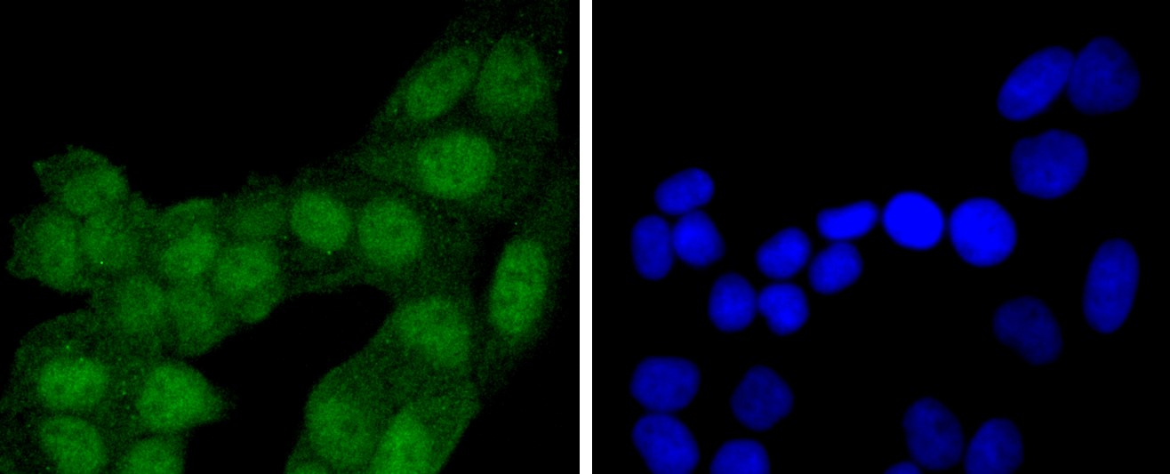 IF(ICC) staining with eIF4EBP1 (9C1) Monoclonal Antibody (bsm-52771R) at 1:100 in HeLa cells (green). The nuclear counterstain is DAPI (blue). Cells were fixed in paraformaldehyde, permeabilized with 0.25% Triton X100/PBS.