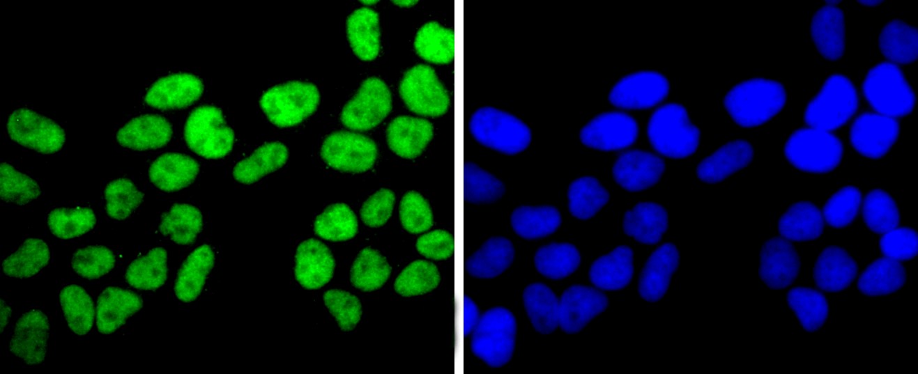 IF(ICC) staining with FUS/TLS (8C1) Monoclonal Antibody (bsm-52774R) at 1:100 in HeLa cells (green). The nuclear counterstain is DAPI (blue). Cells were fixed in paraformaldehyde, permeabilized with 0.25% Triton X100/PBS.