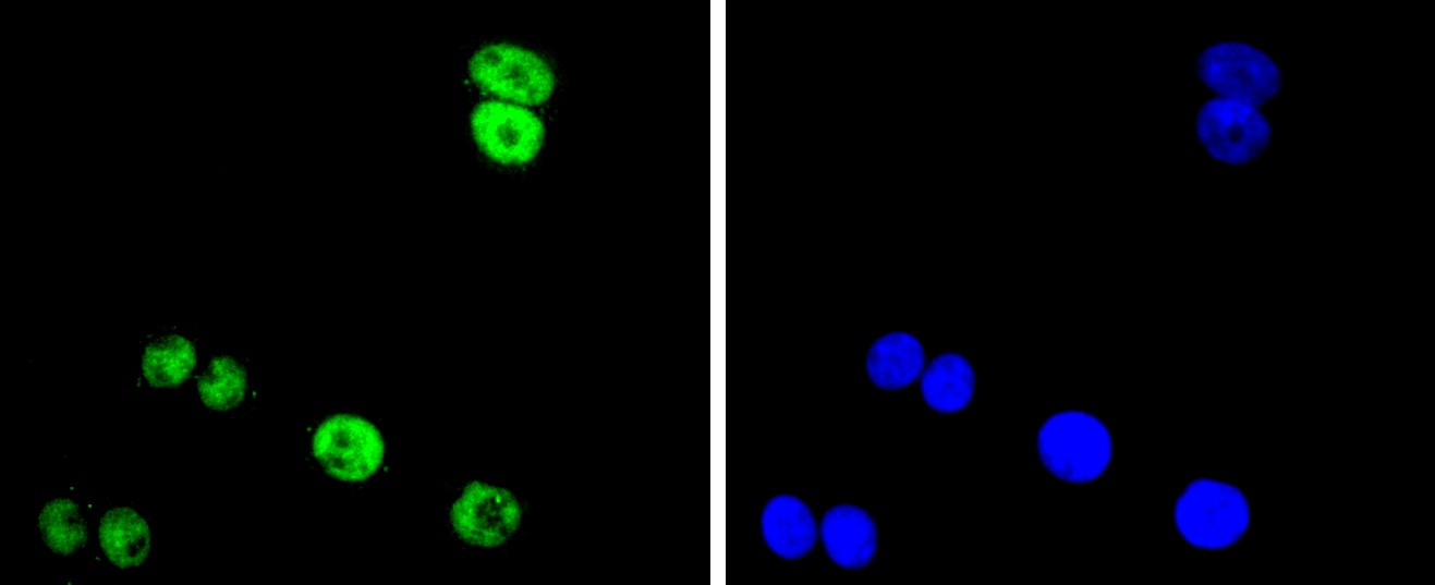 IF(ICC) staining with FUS/TLS (8C1) Monoclonal Antibody (bsm-52774R) at 1:100 in SW480 cells (green). The nuclear counterstain is DAPI (blue). Cells were fixed in paraformaldehyde, permeabilized with 0.25% Triton X100/PBS.