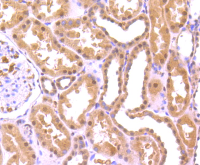 Paraformaldehyde-fixed and paraffin-embedded Human kidney tissue incubated with FUS/TLS (8C1) Monoclonal Antibody (bsm-52774R) at 1:100, overnight at 4°C, followed by a conjugated secondary antibody and DAB staining. Counterstained with hematoxylin.