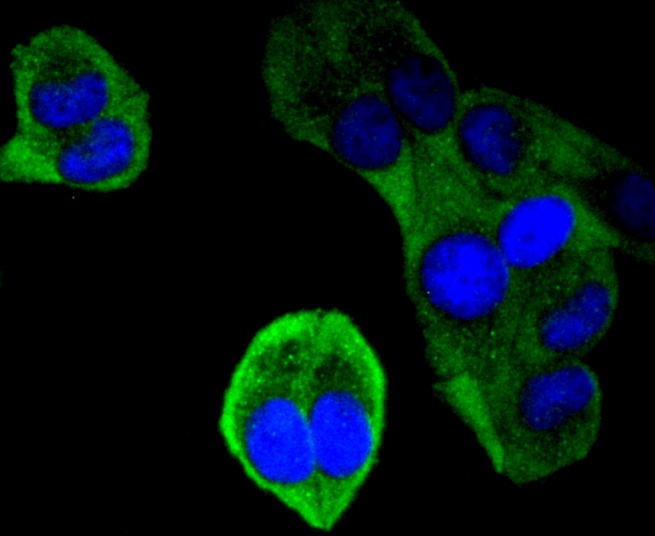 IF(ICC) staining with Ubiquitin D (5C1) Monoclonal Antibody (bsm-52778R) at 1:300 in HeLa cells (green). The nuclear counterstain is DAPI (blue). Cells were fixed in paraformaldehyde, permeabilized with 0.25% Triton X100/PBS.