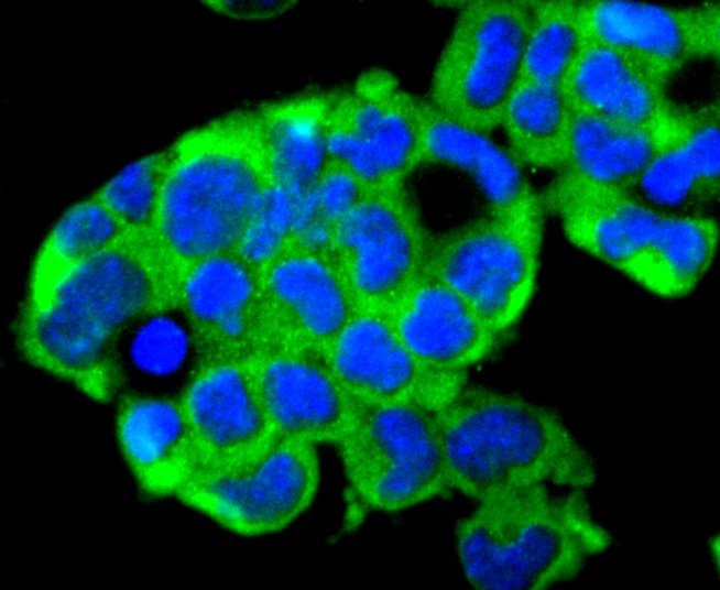 IF(ICC) staining with Ubiquitin D (5C1) Monoclonal Antibody (bsm-52778R) at 1:300 in F9 cells (green). The nuclear counterstain is DAPI (blue). Cells were fixed in paraformaldehyde, permeabilized with 0.25% Triton X100/PBS.