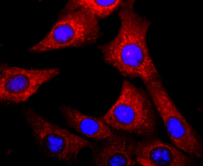IF(ICC) staining with Aryl hydrocarbon Receptor (3C7) Monoclonal Antibody (bsm-52886R) at 1:200 in NIH-3T3 cells (red). The nuclear counterstain is DAPI (blue). Cells were fixed in paraformaldehyde, permeabilized with 0.25% Triton X100/PBS.