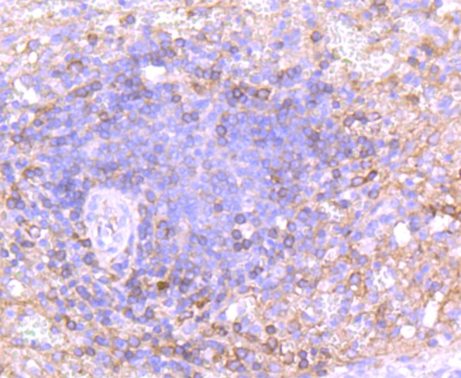 Paraformaldehyde-fixed and paraffin-embedded Human spleen tissue incubated with IgA (2C8) Monoclonal Antibody (bsm-52885R) at 1:100, overnight at 4°C, followed by a conjugated secondary antibody and DAB staining. Counterstained with hematoxylin.