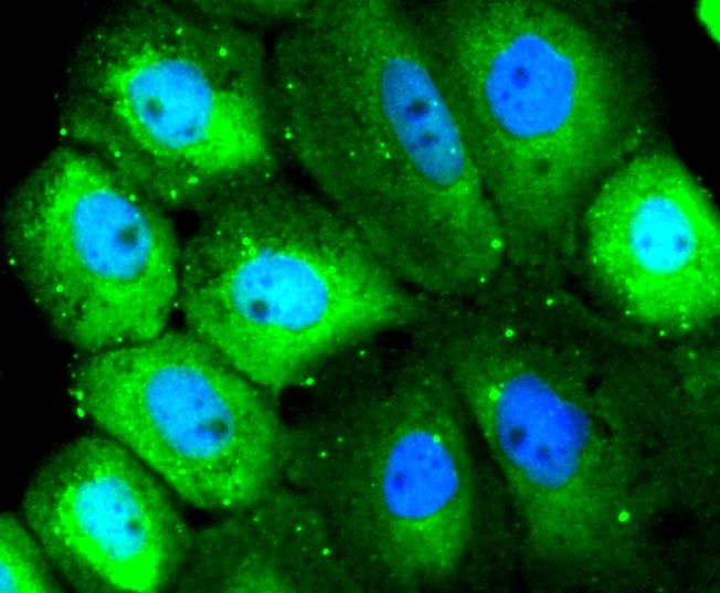 IF(ICC) staining with Src (8C4) Monoclonal Antibody (bsm-52790R) at 1:300 in A431 cells (green). The nuclear counterstain is DAPI (blue). Cells were fixed in paraformaldehyde, permeabilized with 0.25% Triton X100/PBS.