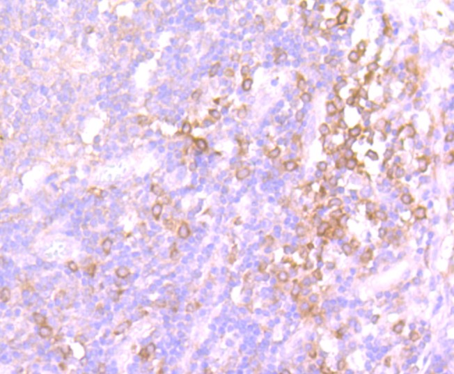 Paraformaldehyde-fixed and paraffin-embedded Human tonsil tissue incubated with Src (8C4) Monoclonal Antibody (bsm-52790R) at 1:100, overnight at 4°C, followed by a conjugated secondary antibody and DAB staining. Counterstained with hematoxylin.