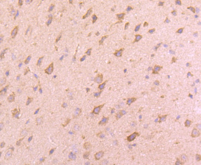 Paraformaldehyde-fixed and paraffin-embedded Mouse brain tissue incubated with VAMP8 (1C1) Monoclonal Antibody (bsm-52796R) at 1:100, overnight at 4°C, followed by a conjugated secondary antibody and DAB staining. Counterstained with hematoxylin.
