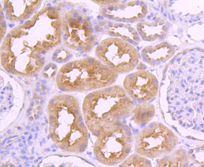 Paraformaldehyde-fixed and paraffin-embedded Human kidney tissue incubated with VAMP8 (1C1) Monoclonal Antibody (bsm-52796R) at 1:100, overnight at 4°C, followed by a conjugated secondary antibody and DAB staining. Counterstained with hematoxylin.