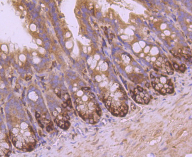 Paraformaldehyde-fixed and paraffin-embedded Mouse colon tissue incubated with VAMP8 (1C1) Monoclonal Antibody (bsm-52796R) at 1:100, overnight at 4°C, followed by a conjugated secondary antibody and DAB staining. Counterstained with hematoxylin.