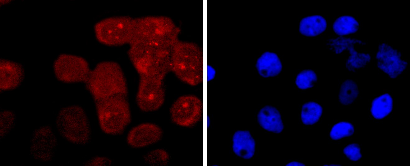 IF(ICC) staining with RAGE (8G4) Monoclonal Antibody (bsm-52809R) at 1:100 in A431 cells (red). The nuclear counterstain is DAPI (blue). Cells were fixed in paraformaldehyde, permeabilized with 0.25% Triton X100/PBS.