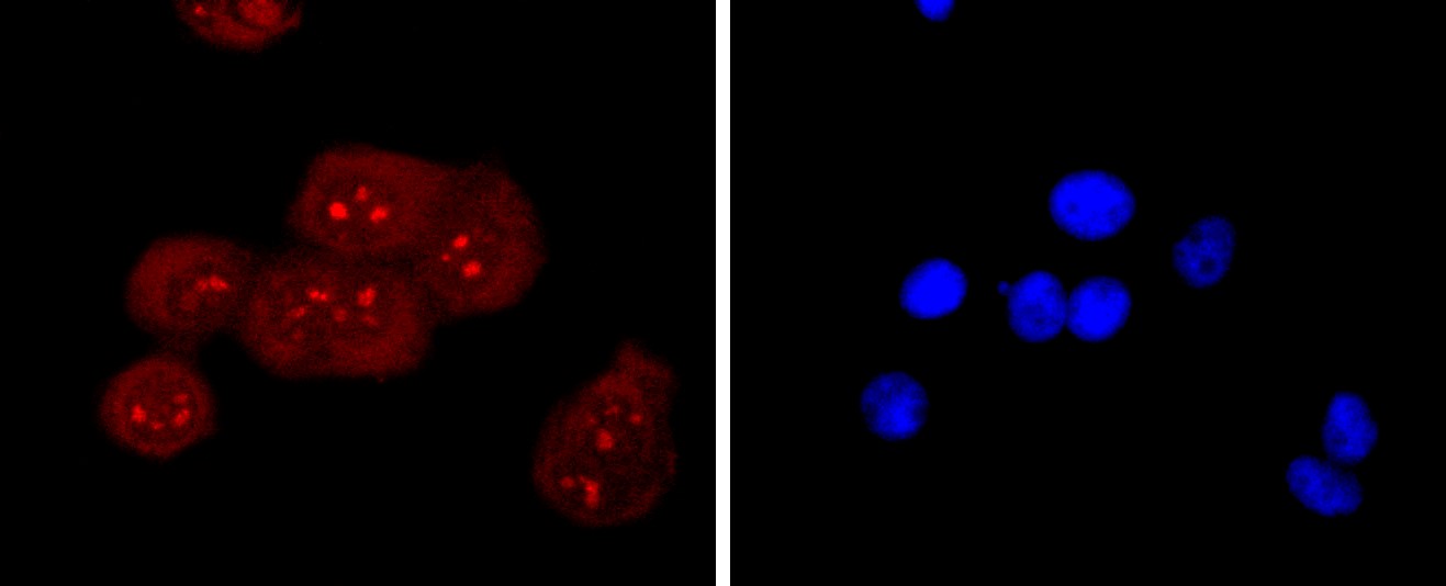 IF(ICC) staining with RAGE (8G4) Monoclonal Antibody (bsm-52809R) at 1:100 in MCF-7 cells (red). The nuclear counterstain is DAPI (blue). Cells were fixed in paraformaldehyde, permeabilized with 0.25% Triton X100/PBS.