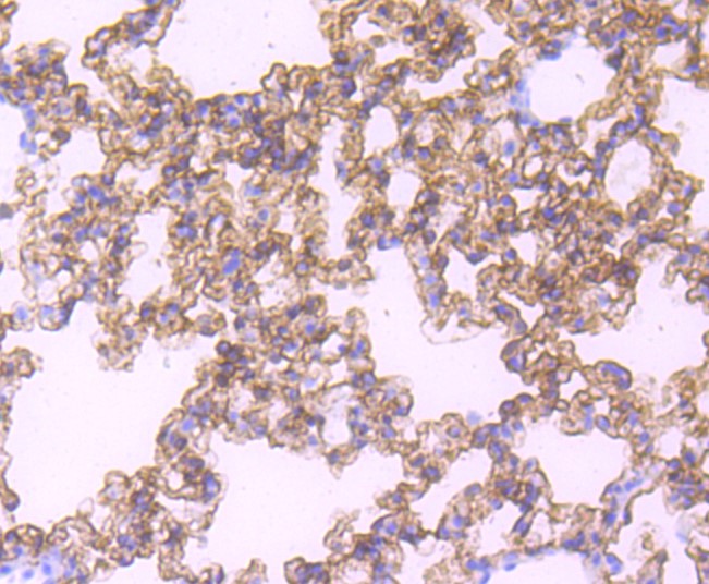 Paraformaldehyde-fixed and paraffin-embedded Mouse lung tissue incubated with RAGE (8G4) Monoclonal Antibody (bsm-52809R) at 1:100, overnight at 4°C, followed by a conjugated secondary antibody and DAB staining. Counterstained with hematoxylin.
