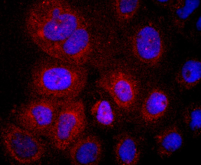 IF(ICC) staining with LYVE1 (5C1) Monoclonal Antibody (bsm-52811R) at 1:100 in A431 cells (red). The nuclear counterstain is DAPI (blue). Cells were fixed in paraformaldehyde, permeabilized with 0.25% Triton X100/PBS.