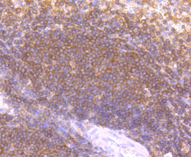 Paraformaldehyde-fixed and paraffin-embedded Human spleen tissue incubated with LYVE1 (5C1) Monoclonal Antibody (bsm-52811R) at 1:100, overnight at 4°C, followed by a conjugated secondary antibody and DAB staining. Counterstained with hematoxylin.