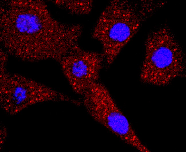 IF(ICC) staining with Thymidine Kinase 1 (9C1) Monoclonal Antibody (bsm-52813R) at 1:100 in NIH/3T3 cells (red). The nuclear counterstain is DAPI (blue). Cells were fixed in paraformaldehyde, permeabilized with 0.25% Triton X100/PBS.