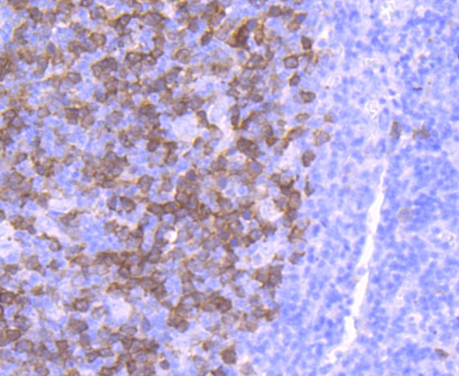 Paraformaldehyde-fixed and paraffin-embedded Human tonsil tissue incubated with Thymidine Kinase 1 (9C1) Monoclonal Antibody (bsm-52813R) at 1:100, overnight at 4°C, followed by a conjugated secondary antibody and DAB staining. Counterstained with hematoxylin.