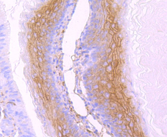 Paraformaldehyde-fixed and paraffin-embedded Mouse stomach tissue incubated with gamma Catenin (5C1) Monoclonal Antibody (bsm-52815R) at 1:100, overnight at 4°C, followed by a conjugated secondary antibody and DAB staining. Counterstained with hematoxylin.