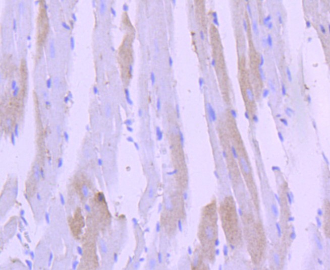 Paraformaldehyde-fixed and paraffin-embedded Human heart tissue incubated with Cardiac Troponin I (4C2) Monoclonal Antibody (bsm-52818R) at 1:100, overnight at 4\u00b0C, followed by a conjugated secondary antibody and DAB staining. Counterstained with hematoxylin.