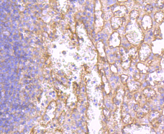 Paraformaldehyde-fixed and paraffin-embedded Human spleen tissue incubated with MHC class I (10G4) Monoclonal Antibody (bsm-52827R) at 1:100, overnight at 4°C, followed by a conjugated secondary antibody and DAB staining. Counterstained with hematoxylin.