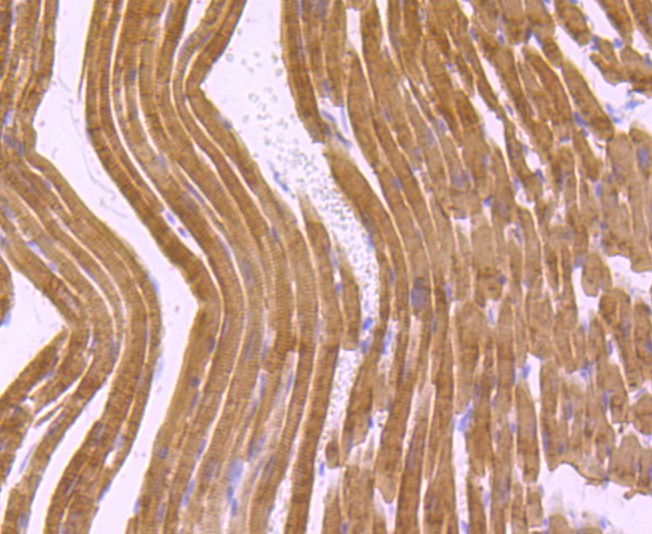 Paraformaldehyde-fixed and paraffin-embedded Mouse heart tissue incubated with Myosin heavy chain (8C1) Monoclonal Antibody (bsm-52867R) at 1:100, overnight at 4°C, followed by a conjugated secondary antibody and DAB staining. Counterstained with hematoxylin.