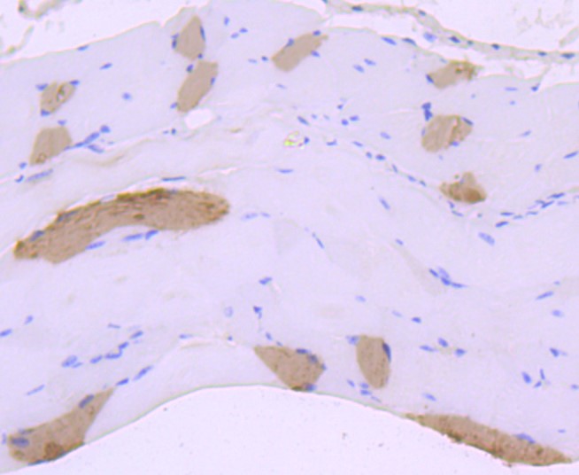 Paraformaldehyde-fixed and paraffin-embedded Mouse smooth muscle tissue incubated with Myosin heavy chain (8C1) Monoclonal Antibody (bsm-52867R) at 1:100, overnight at 4°C, followed by a conjugated secondary antibody and DAB staining. Counterstained with hematoxylin.