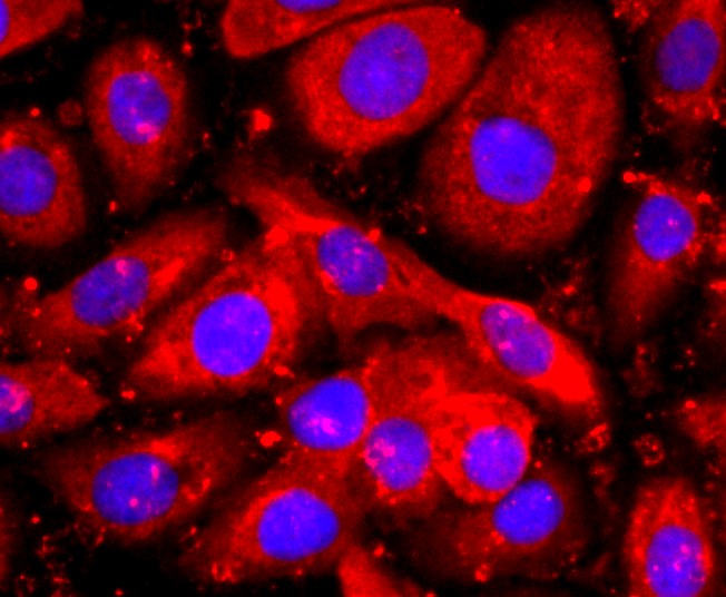 IF(ICC) staining with HE4 (8C3) Monoclonal Antibody (bsm-52840R) at 1:100 in SKOV-3 cells (red). The nuclear counterstain is DAPI (blue). Cells were fixed in paraformaldehyde, permeabilized with 0.25% Triton X100/PBS.