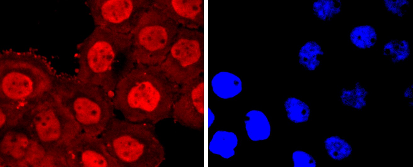 IF(ICC) staining with Annexin V (6C7) Monoclonal Antibody (bsm-52841R) at 1:300 in A431 cells (red). The nuclear counterstain is DAPI (blue). Cells were fixed in paraformaldehyde, permeabilized with 0.25% Triton X100/PBS.