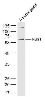 Mouse Adrenal Gland lysate at 40µg; Probed with Nurr1 Polyclonal Antibody, Unconjugated (bs-20744R) at 1:300 overnight at 4°C followed by incubation with a conjugated secondary antibody at 1:20000 for 60 minutes at 37°C.