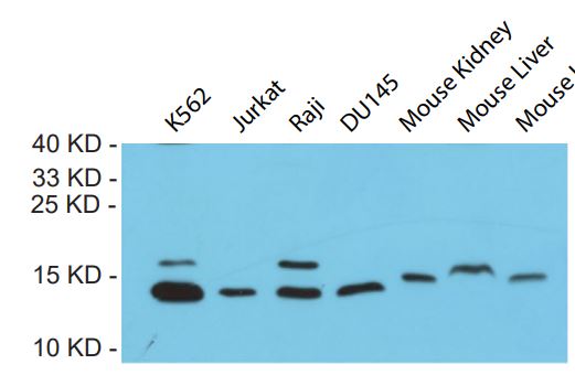 Lane 1: K562; Lane 2: Jurkat; Lane 3: Raji; Lane 4: DU145; Lane 5: mouse kidney; Lane 6: mouse liver; Lane 7: mouse heart lysates, probed with FRATAXIN (2G1) Monoclonal Antibody, Unconjugated (bsm-58001R) at 1:1000 dilution and 4°C overnight incubation. Followed by conjugated secondary antibody incubation at 1:20000 for 60 min at 37°C.