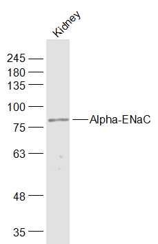 Rat kidney lysate at 40\u00b5g; Probed with Alpha-ENaC Polyclonal Antibody, Unconjugated (bs-2957R) at 1:1000 overnight at 4\u00b0C followed by incubation with a conjugated secondary antibody at 1:20000 for 60 minutes at 37\u00b0C.