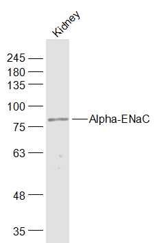 Rat kidney lysate at 40µg; Probed with Alpha-ENaC Polyclonal Antibody, Unconjugated (bs-2957R) at 1:1000 overnight at 4°C followed by incubation with a conjugated secondary antibody at 1:20000 for 60 minutes at 37°C.