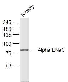 Mouse kidney lysate at 40\u00b5g; Probed with Alpha-ENaC Polyclonal Antibody, Unconjugated (bs-2957R) at 1:1000 overnight at 4\u00b0C followed by incubation with a conjugated secondary antibody at 1:20000 for 60 minutes at 37\u00b0C.