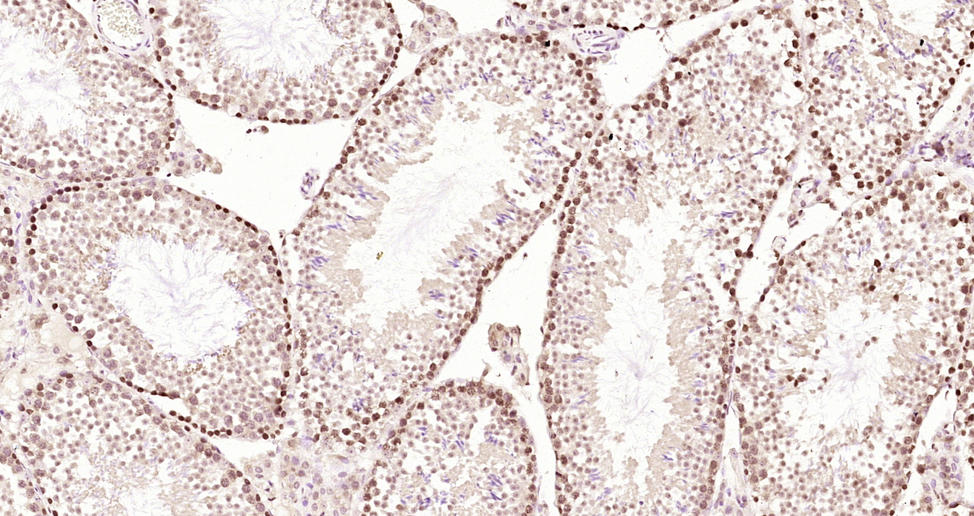 Paraformaldehyde-fixed, paraffin embedded Mouse testis; Antigen retrieval by boiling in sodium citrate buffer (pH6.0) for 15min; Block endogenous peroxidase by 3% hydrogen peroxide for 20 minutes; Blocking buffer (normal goat serum) at 37°C for 30min; Antibody incubation with LYK5 Polyclonal Antibody, Unconjugated (bs-3949R) at 1:200 overnight at 4°C, DAB staining.