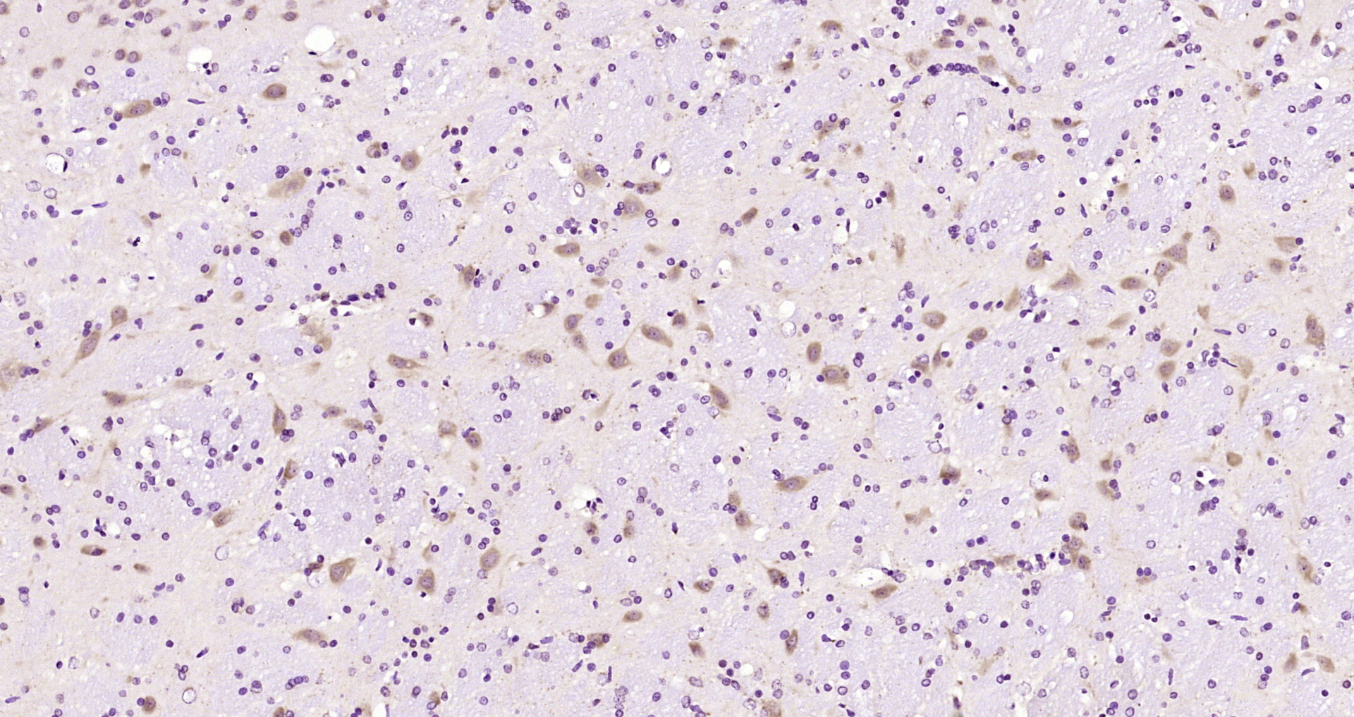 Paraformaldehyde-fixed, paraffin embedded Rat brain; Antigen retrieval by boiling in sodium citrate buffer (pH6.0) for 15min; Block endogenous peroxidase by 3% hydrogen peroxide for 20 minutes; Blocking buffer (normal goat serum) at 37°C for 30min; Antibody incubation with NALP12 Polyclonal Antibody, Unconjugated (bs-6864R) at 1:200 overnight at 4°C, DAB staining.