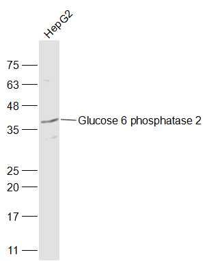 Human HepG2 cell lysate at 30µg; Probed with Glucose 6 phosphatase 2/IGRP Polyclonal Antibody, Unconjugated (bs-13386R) at 1:1000 overnight at 4°C followed by incubation with a conjugated secondary antibody at 1:20000 for 60 minutes at 37°C. Human HepG2 cell lysate at 30µg; Probed with Glucose 6 phosphatase 2/IGRP Polyclonal Antibody, Unconjugated (bs-13386R) at 1:1000 overnight at 4°C followed by incubation with a conjugated secondary antibody at 1:20000 for 60 minutes at 37°C.