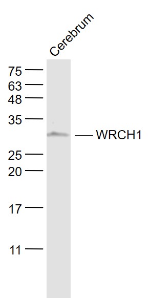 Mouse cerebrum lysates probed with WRCH-1 Polyclonal Antibody, Unconjugated (bs-1944R) at 1:1000 dilution and 4˚C overnight incubation. Followed by conjugated secondary antibody incubation at 1:20000 for 60 min at 37˚C.
