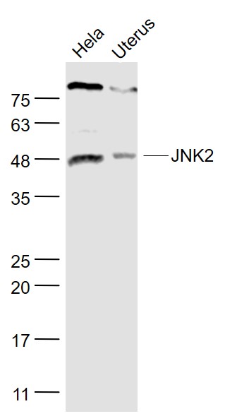 Lane 1: Hela cell lysates; Lane 2: Mouse uterus lysates probed with JNK1/2 Polyclonal Antibody, Unconjugated (bs-2900R) at 1:1000 dilution and 4˚C overnight incubation. Followed by conjugated secondary antibody incubation at 1:20000 for 60 min at 37˚C.