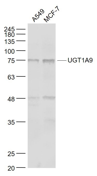 Lane 1: A549 cell lysates; Lane 2: MCF-7 cell lysates probed with UGT1A9 Polyclonal Antibody, Unconjugated (bs-4224R) at 1:1000 dilution and 4˚C overnight incubation. Followed by conjugated secondary antibody incubation at 1:20000 for 60 min at 37˚C.