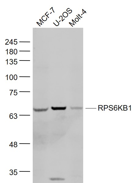 Lane 1: MCF-7 cell lysates;Lane 2: U-2os cell lysates; Lane 3: Molt-4 cell lysates probed with p70 S6 kinase alpha Polyclonal Antibody, Unconjugated (bs-6370R) at 1:1000 dilution and 4˚C overnight incubation. Followed by conjugated secondary antibody incubation at 1:20000 for 60 min at 37˚C.